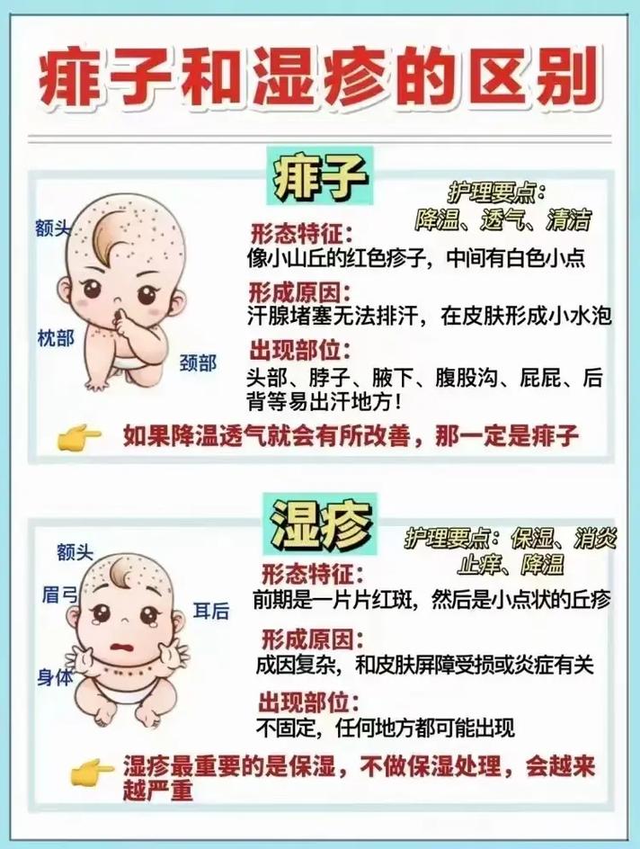 湿疹注意什么供卵助孕宝宝